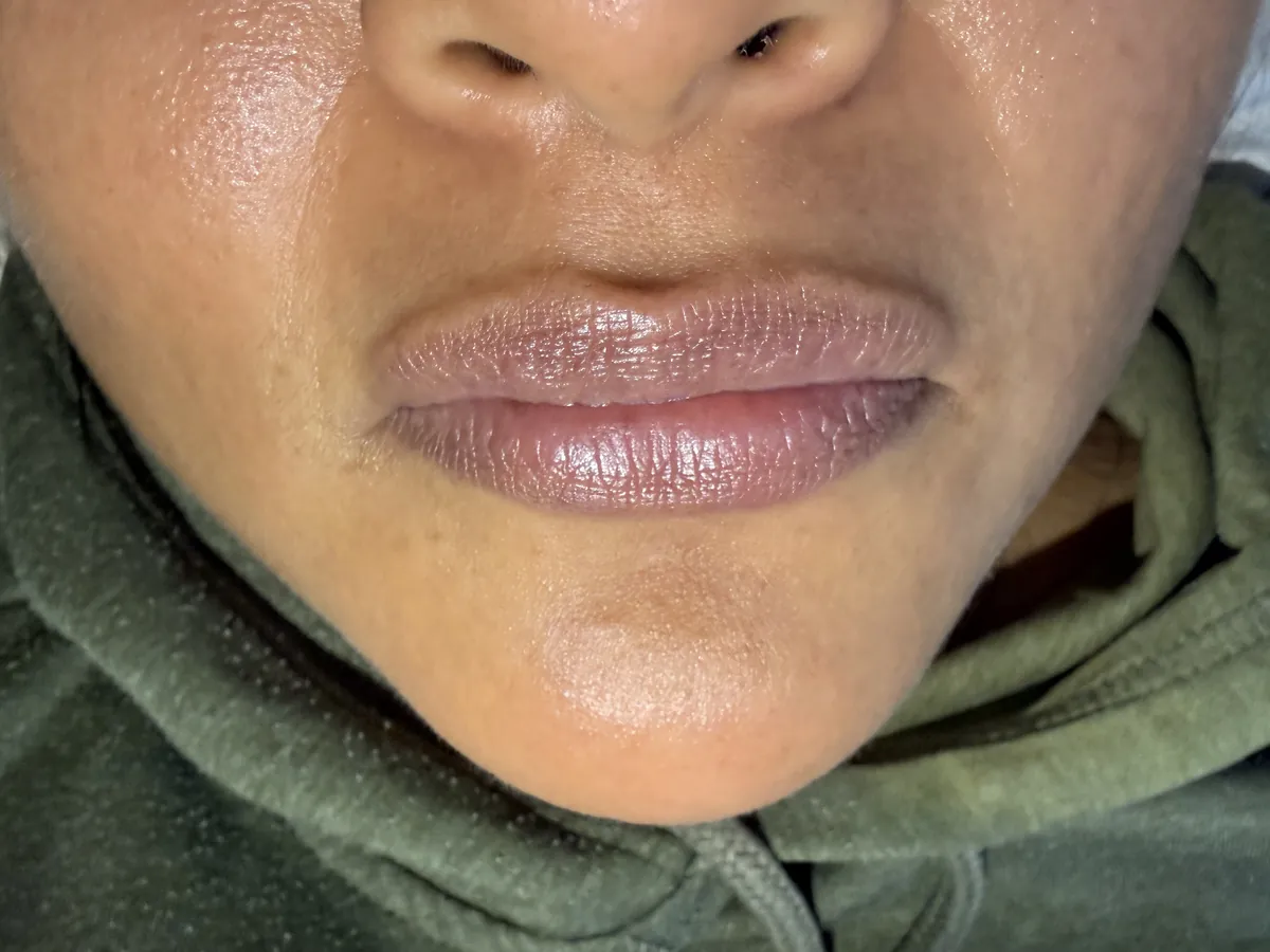 Labios antes, con tono apagado